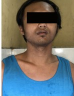 Pria Karang Tembok Curi Cincin Kawin dan Jam Tangan Lewat Jendela Rumah
