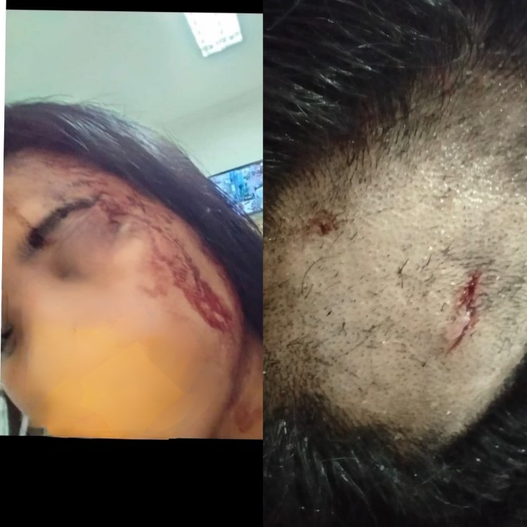 Korban dan luka dikepalanya