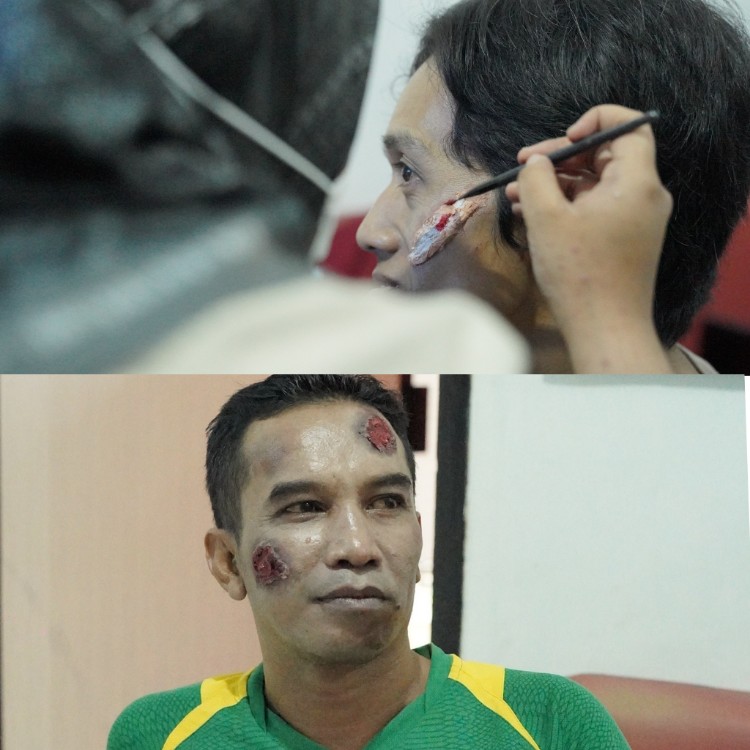 Korban kecelakaan lalulintas (ilustrasi)